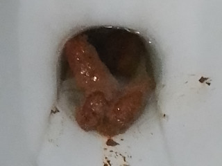 My poop