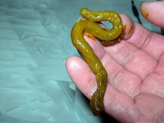 A snake's poop crawled out of a child's butt!